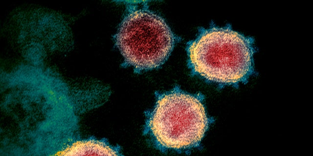 This electron microscope image made available by the U.S. National Institutes of Health in February 2020 shows the coronavirus that causes COVID-19. The sample was isolated from a patient in the U.S. (NIAID-RML via AP)