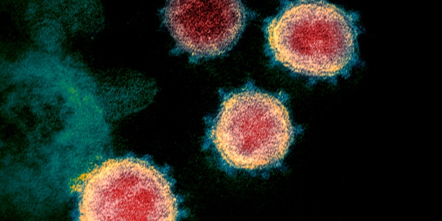 This electron microscope image made available by the U.S. National Institutes of Health in February 2020 shows the coronavirus that causes COVID-19. The sample was isolated from a patient in the U.S. (NIAID-RML via AP)