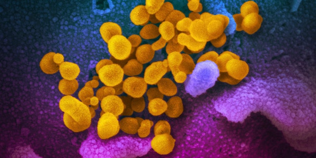 FILE - This undated electron microscope image made available by the U.S. National Institutes of Health in February 2020 shows the Novel Coronavirus SARS-CoV-2, yellow, emerging from the surface of cells, blue/pink, cultured in the lab. The sample was isolated from a patient in the U.S. The federal Centers for Disease Control and Prevention is warning doctors about a rare but serious condition in children linked with the coronavirus. In an alert issued Thursday, the CDC called the condition multisystem inflammatory syndrome in children. (NIAID-RML via AP, File)