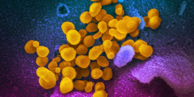 FILE - This undated electron microscope image made available by the U.S. National Institutes of Health in February 2020 shows the Novel Coronavirus SARS-CoV-2, yellow, emerging from the surface of cells, blue/pink, cultured in the lab. The sample was isolated from a patient in the U.S. The federal Centers for Disease Control and Prevention is warning doctors about a rare but serious condition in children linked with the coronavirus. In an alert issued Thursday, the CDC called the condition multisystem inflammatory syndrome in children. (NIAID-RML via AP, File)