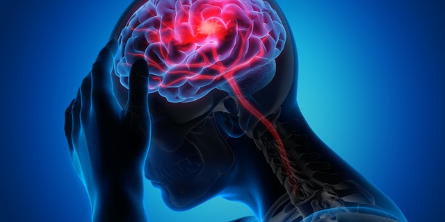 Ilustrație medicală a creierului cu simptome de accident vascular cerebral.  Cercetătorii au descoperit că riscul de accident vascular cerebral ischemic este crescut în rândul pacienților spitalizați cu COVID-19, comparativ cu pacienții internați cu gripă. 