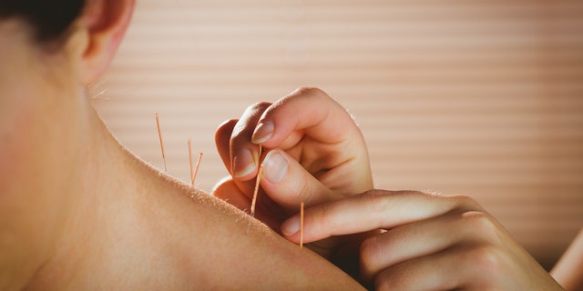 A group of researchers in China say acupuncture may help relieve discomfort from ingestion. (iStock)