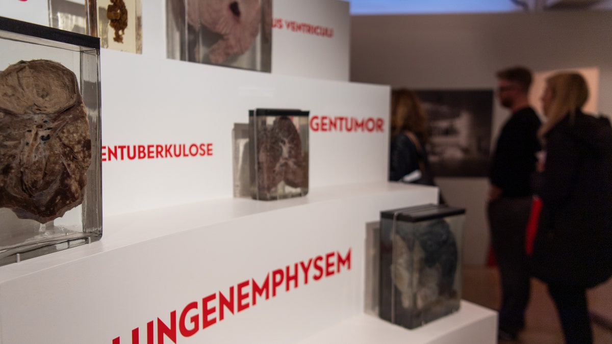 21 March 2019, Berlin: Medical exhibits can be found in the exhibition "Auf Messers Schneide" in the Medical History Museum of the Charite - file photo.