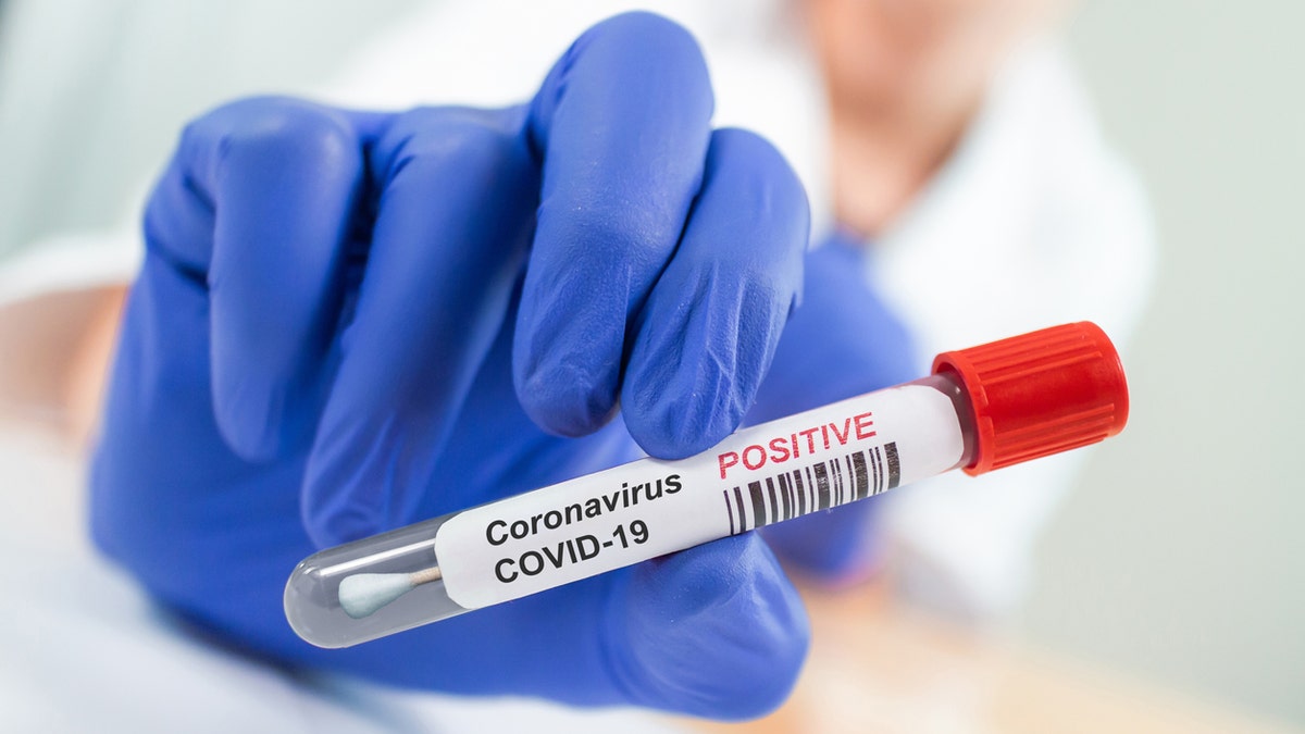 A study found "long COVID" symptoms may be caused by trapped inflammatory cells in micro blood clots.