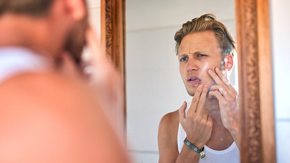 For those prone to acne, experts generally recommend products containing salicylic acid or benzoyl peroxide (at a concentration of 5.5 percent or less). (iStock)