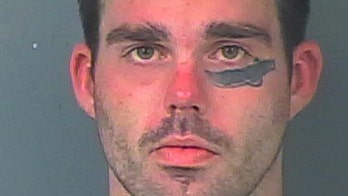 Man sporting machete tattoo on face allegedly involved in machete attack