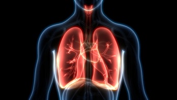 Some severe coronavirus cases see 'complete disruption of lung architecture,' doctor warns
