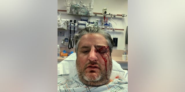 Guardian Angel, Aram Sabet, sustained a broken eye socket and broken nose, and received 48 stitches (Guardian Angels)