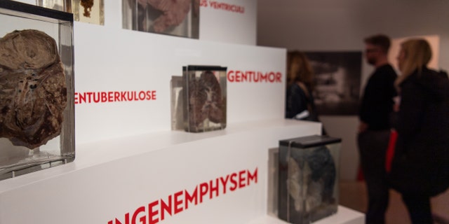 21 March 2019, Berlin: Medical exhibits can be found in the exhibition "Auf Messers Schneide" in the Medical History Museum of the Charite - file photo.