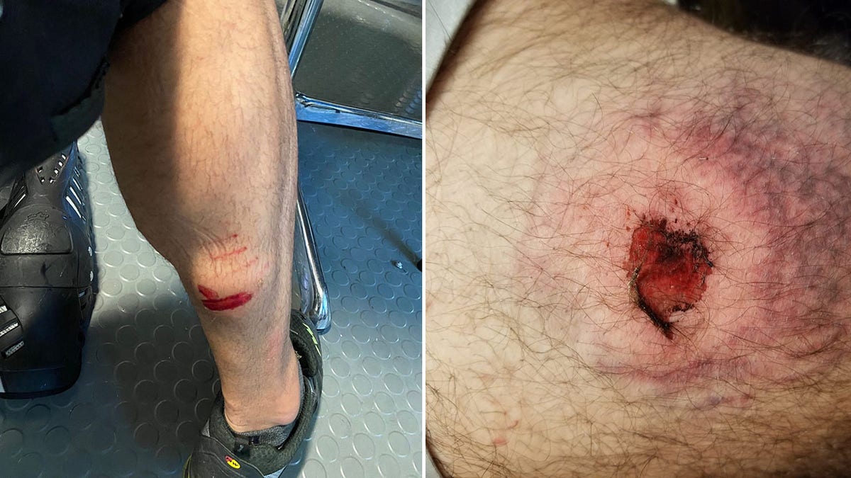 Polce said an officer, left, suffered an abrasion to his leg from an explosive device, while another, right, sustained a burn.