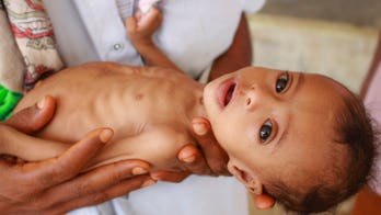 Millions of Yemen's children face starvation as coronavirus outbreak worsens, UNICEF warns