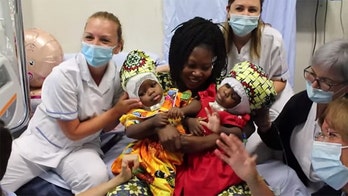 Conjoined twins with fused skulls successfully separated at Vatican hospital, doctors say