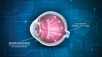 Diet may lower glaucoma subtype risk by 20 percent, researchers say