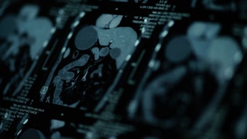 German coronavirus studies identify heart issues in COVID-19 patients