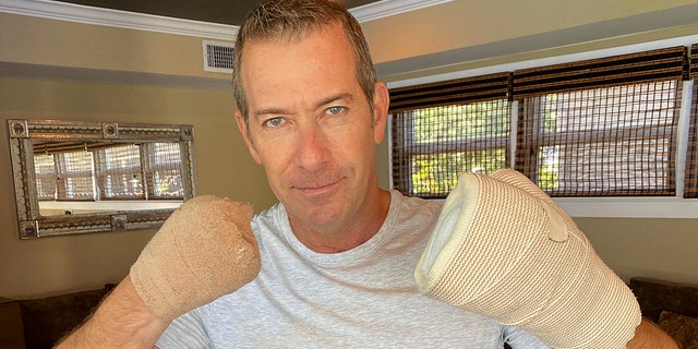 Most of Gregg Garfield's fingers were amputated during a two-month hospital stay for coronavirus. (Photo courtesy of AJ Johnson)