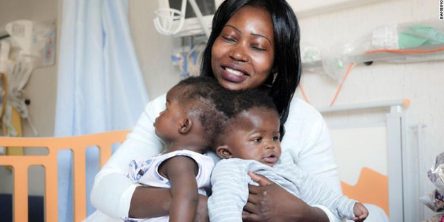 The girls were conjoined by the back of their skulls. (Photo courtesy of Bambino Gesu Pediatric Hospital)
