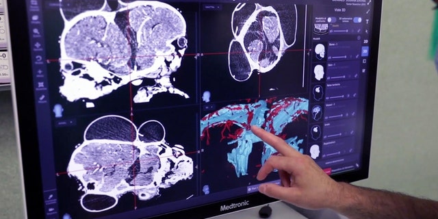 A doctor examines imaging of the twin girls' skulls at the Vatican pediatric hospital. (Photo courtesy of Bambino Gesu Pediatric Hospital)