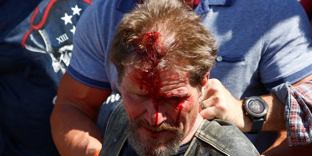 A man bleeds from his head after being injured at a pro-law enforcement rally that clashed with counter-protesters demonstrating against racial inequality, in Denver, Colorado, U.S. July 19, 2020. (Reuters/Kevin Mohatt)