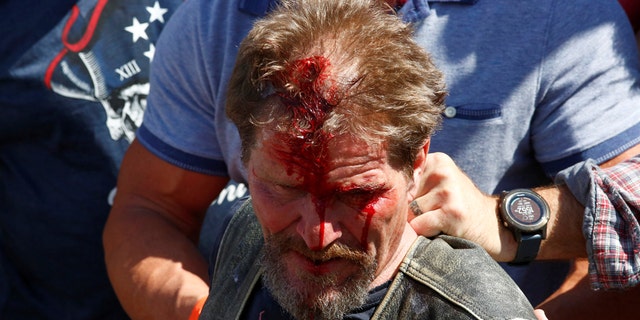 A man bleeds from his head after being injured at a pro-law enforcement rally that clashed with counter-protesters demonstrating against racial inequality, in Denver, Colorado, U.S. July 19, 2020. (Reuters/Kevin Mohatt)