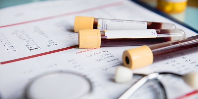 A new blood test was able to spot Alzheimer's disease on par with pricey brain imaging and spinal taps, researchers found. (iStock)