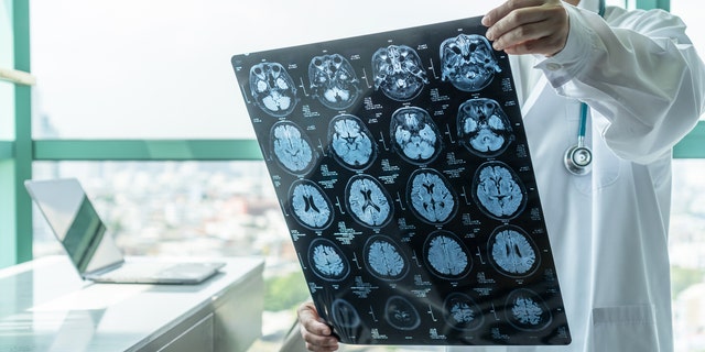 Diagnostika onemocnění mozku pohledem lékaře na film magnetické rezonance (MRI), který diagnostikuje problematiku neurodegenerativních onemocnění staršího pacienta pro neuromedicínskou léčbu.  Když však vědci porovnávali relativní riziko neurologických poruch s jinými respiračními onemocněními, jako je chřipka, zvýšené riziko většiny neurologických onemocnění nebylo u pacientů s COVID-19 vyšší než u pacientů s diagnostikovanými jinými respiračními chorobami – s jedinou výjimkou.  