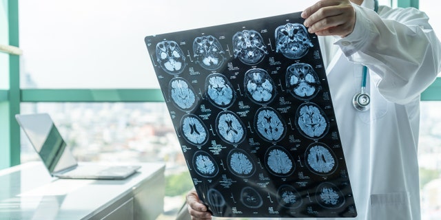 Diagnóstico de enfermedades cerebrales con la visión del médico de una película de resonancia magnética (IRM) que diagnostica el problema de las enfermedades neurodegenerativas de un paciente anciano para tratamiento neuromédico.  Pero cuando los investigadores compararon el riesgo relativo de los trastornos neurológicos con otras enfermedades respiratorias, como la influenza, el mayor riesgo de la mayoría de las enfermedades neurológicas no fue mayor en los pacientes con COVID-19 que en los diagnosticados con otras enfermedades respiratorias, con una excepción.  