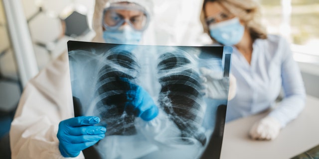 Male and female doctor looking at lungs x-ray in hospital during covid19 pandemic