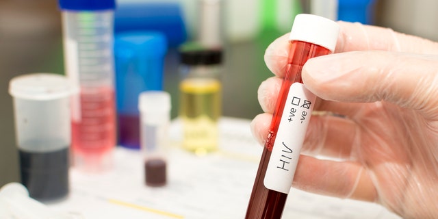 Holds a test tube with blood.  Handwritten HIV label with crossed checkmark.
