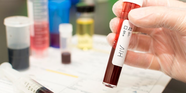 Holding a test tube with blood in it. Handwritten label with HIV on it with the negative tick box crossed.