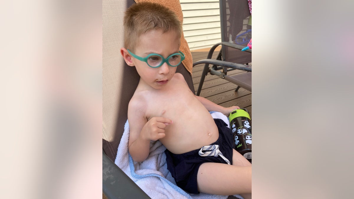 Lucas Spina, 5, is regressing in his walking abilities amid the pandemic.