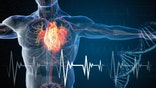 Heart attack graph