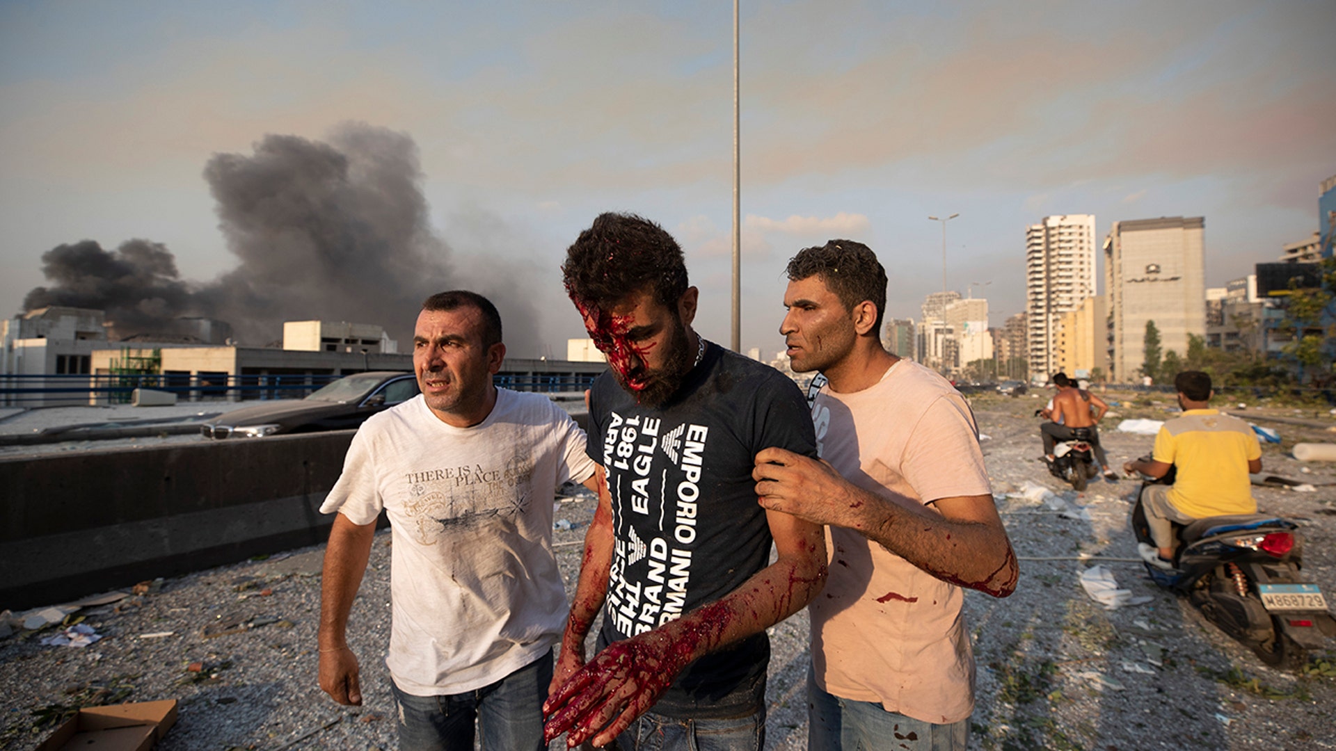 People help a man wounded in a massive explosion in Beirut, Lebanon, Tuesday, Aug. 4, 2020. 