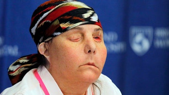 New Hampshire woman is first American to undergo two full face transplants
