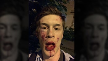 Russian blogger, anti-Kremlin activist attacked outside his apartment