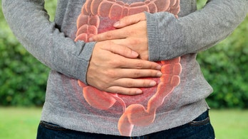 Parasitic infection outbreak in Texas sickens 82 people