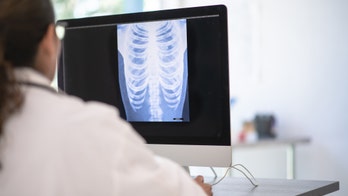 Targeted lung cancer treatments help reduce death rates: study