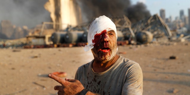 An injured man walks at the explosion scene that hit the seaport, in Beirut Lebanon, Tuesday, Aug. 4, 2020. (Associated Press)