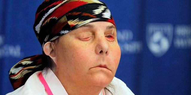 Face transplant recipient Carmen Blandin Tarleton speaks at a news conference at Brigham and Women's Hospital in Boston, Massachusetts May 1, 2013.