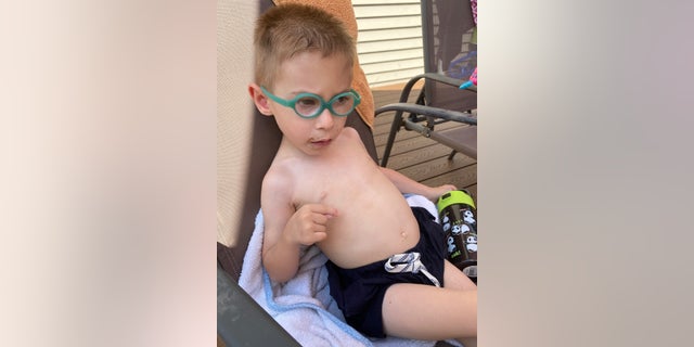 New York coronavirus policy harming disabled youth, parents say: 'The regression is devastating' 6 Lucas Spina, 5, is regressing in his walking abilities amid the pandemic.