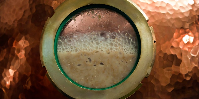 Auto-brewery syndromee is a rare condition involving excessive fungal growth in the gut and ethanol production, leaving the person feeling intoxicated.