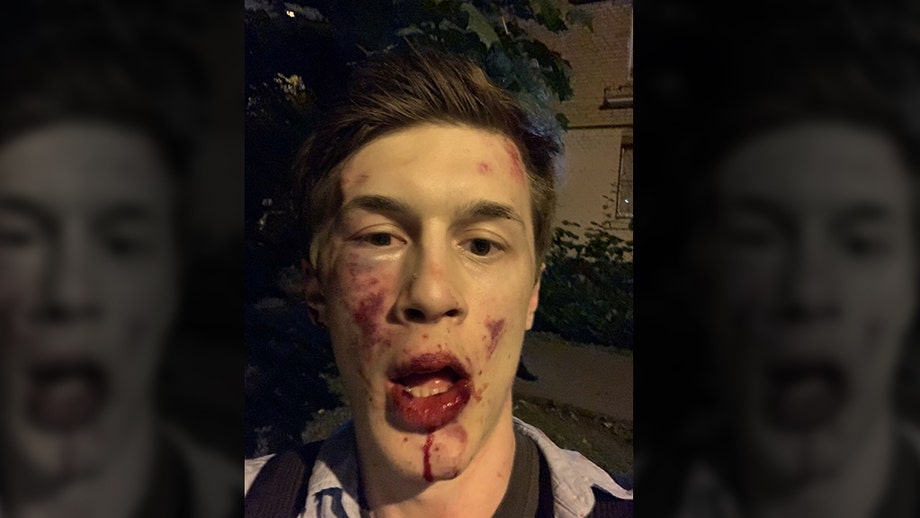 Russian blogger, anti-Kremlin activist attacked outside his apartment