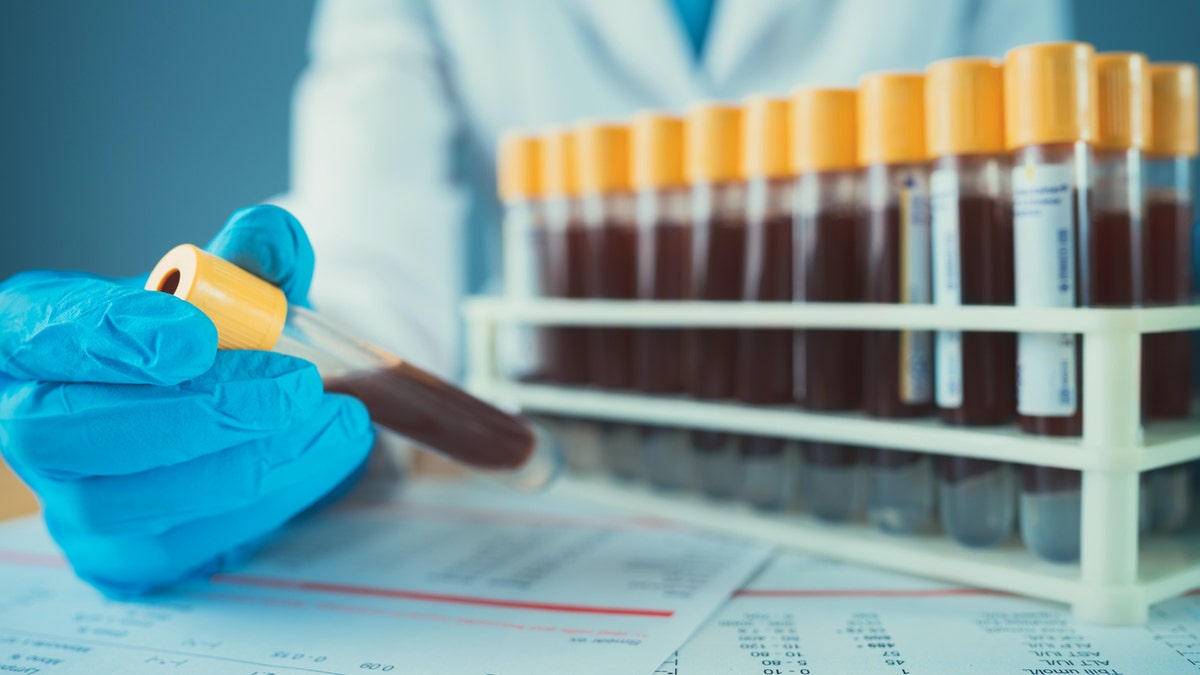 A recent study suggests a standard component of routine blood tests may serve as a useful predictor of COVID-19 severity and risk of mortality. (iStock)