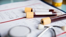 Cancer blood test using DNA fragments brings hope for earlier detection, say researchers