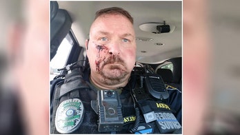 South Carolina police chief stabbed in face with ice pick after answering door