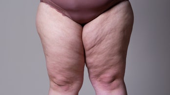 Chubbier legs linked to lower blood pressure: study