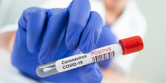 The novel coronavirus was more than twice as contagious at the start of the pandemic than first thought, according to a new study from Duke University. 
