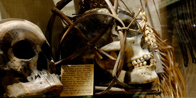 In July 2020, the Pitt Rivers Museum at the University of Oxford removed its shrunken heads and human remains from public display. 
