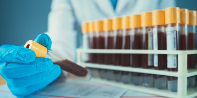 A recent study suggests a standard component of routine blood tests may serve as a useful predictor of COVID-19 severity and risk of mortality. (iStock)