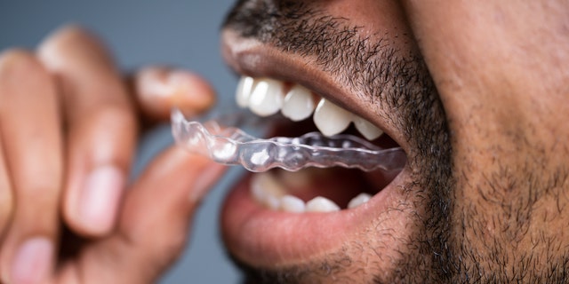 Chen advised using a night guard or retainer to ease grinding and absorb pressure. (iStock)