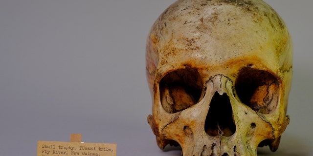 The around 2,800 human remains are now held in storage while the museum reaches out to different communities and cultures about the return of, or better car of the remains.
